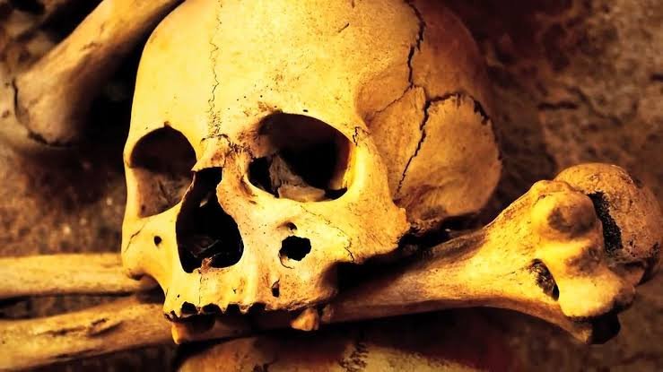 Pneumonic Plague